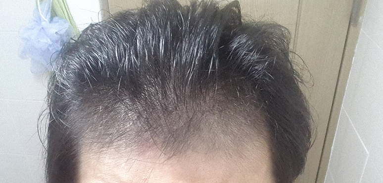 BeautyPlus_20150811235627_save.jpg