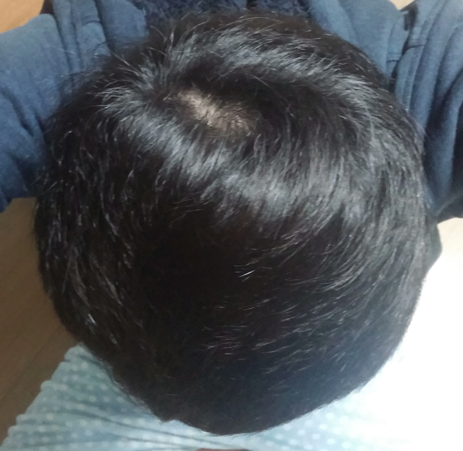 캡처22.PNG
