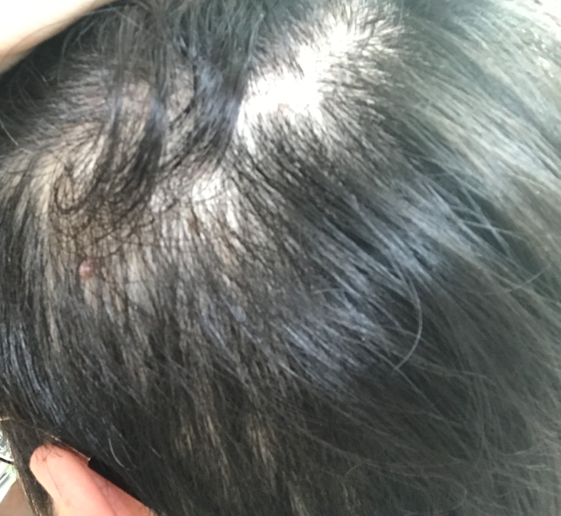 血も9ヶ月も飲んでいますが、これといった効果がないですね
