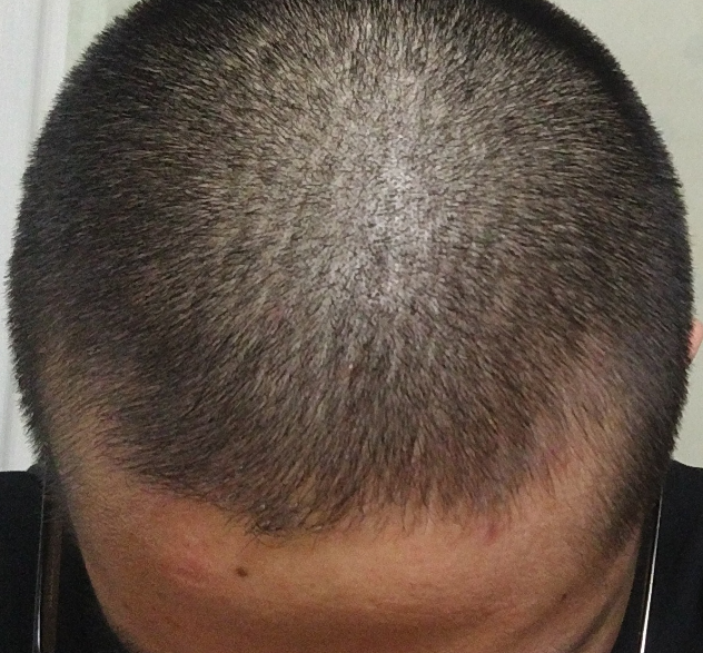 20170321_052956.png