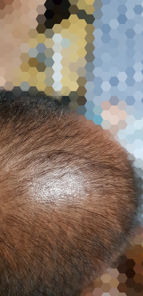Point Blur_Dec252018_133648.jpg