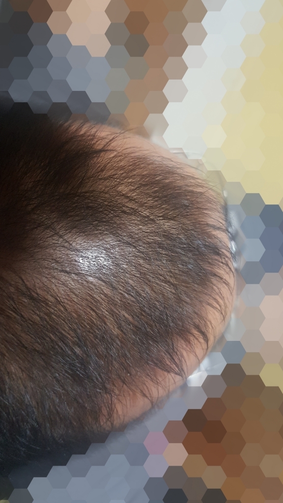 Point Blur_Dec252018_133743.jpg