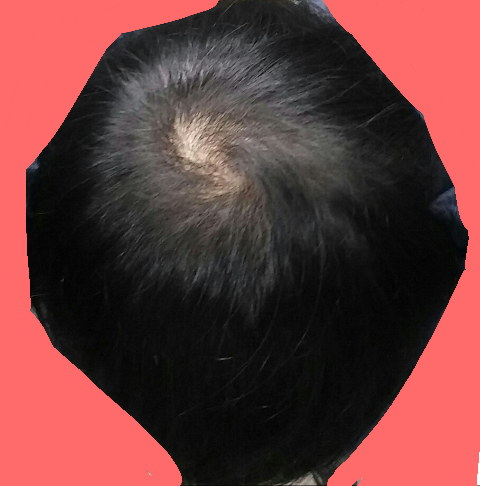 7월3일오후8시.png