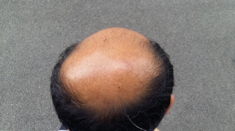 크기변환_20150722_094451.jpg