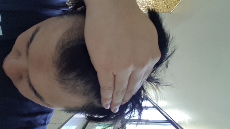 아보다트 6개월이 지났습니다.