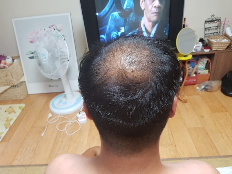 4개월2.jpg