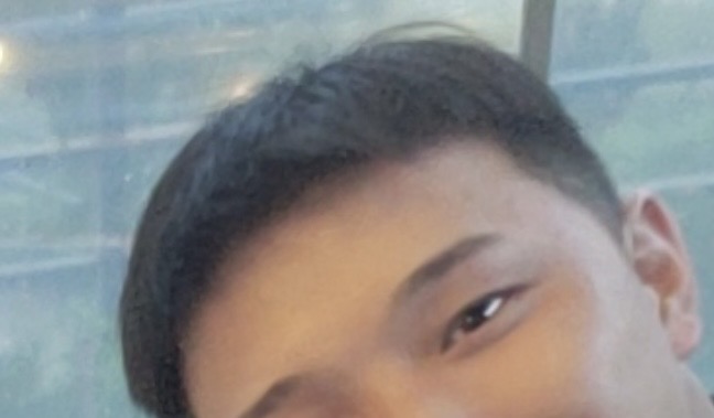 Dongsung Minoxidil 1st day (from birth, top of the head)
