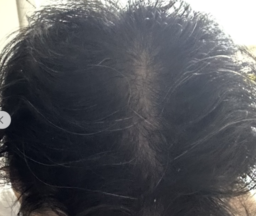 사쿠라허브 에프페시아 후기 