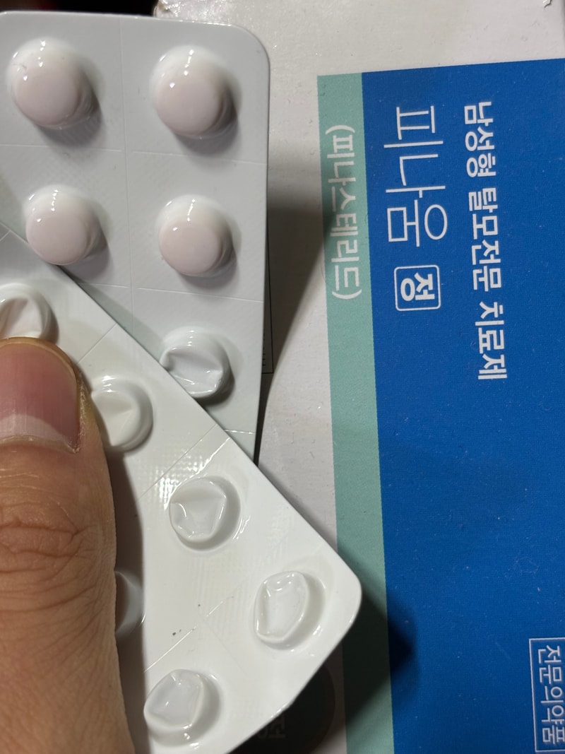 피나모정 1mg 복용후기