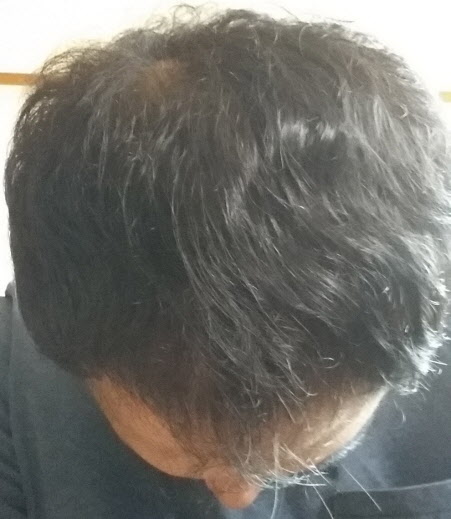 치료후 사진2.jpg