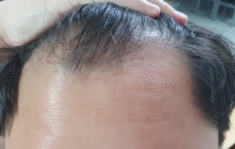3년은 먹은 것 같은데 처참하네요