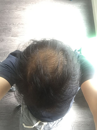 20170811.jpg