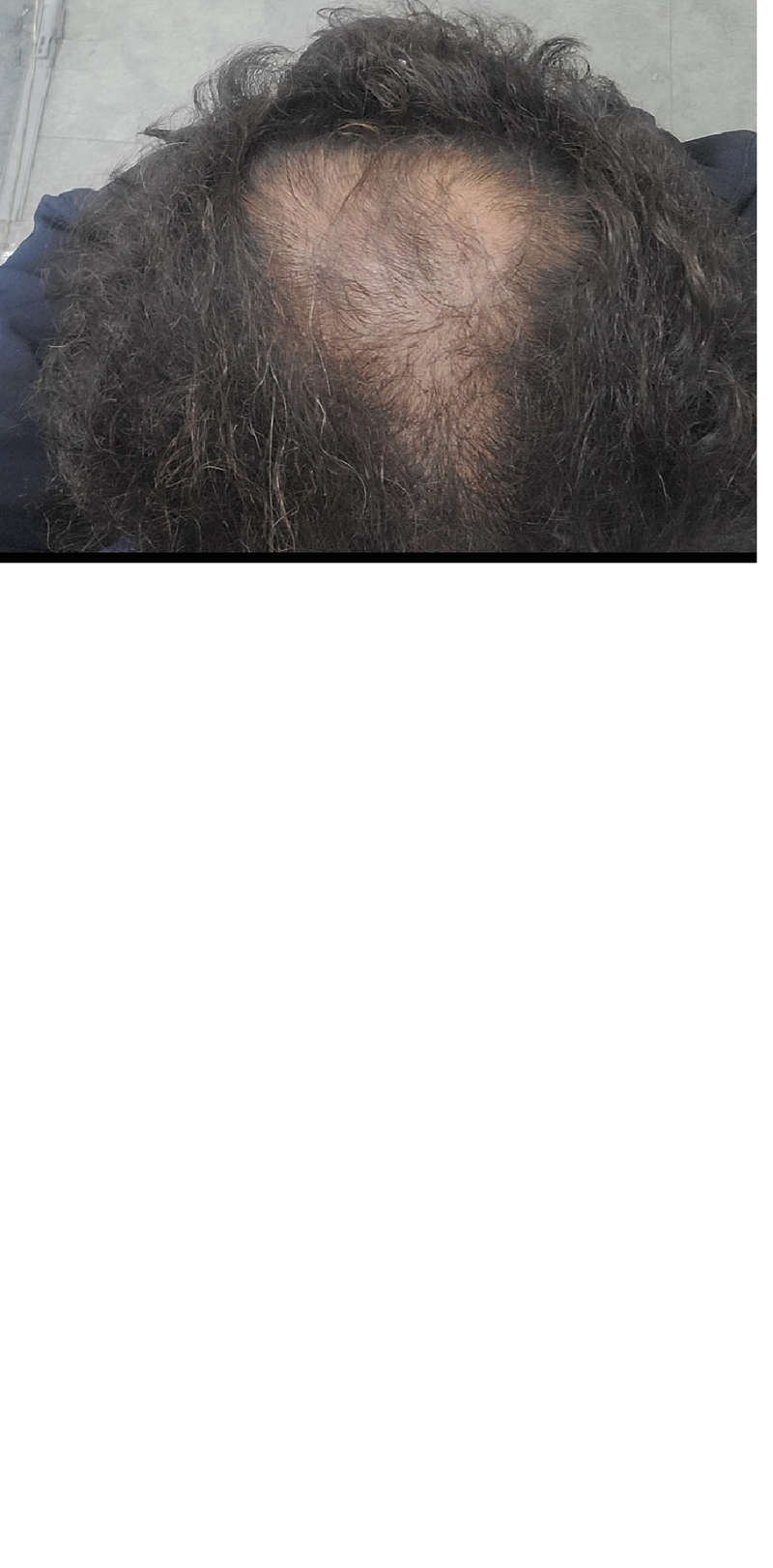 사진 최초.png