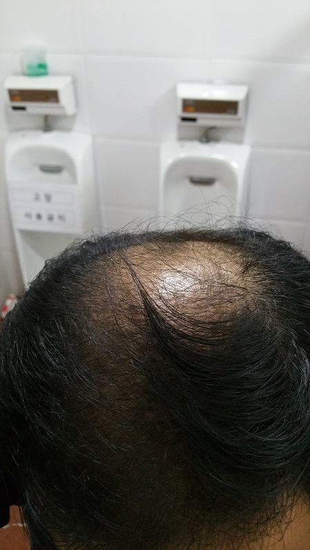 복용후2.jpg