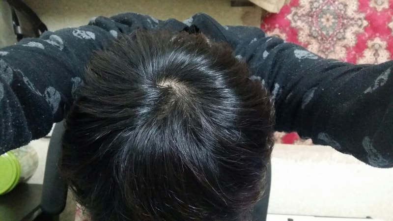 최근.jpg