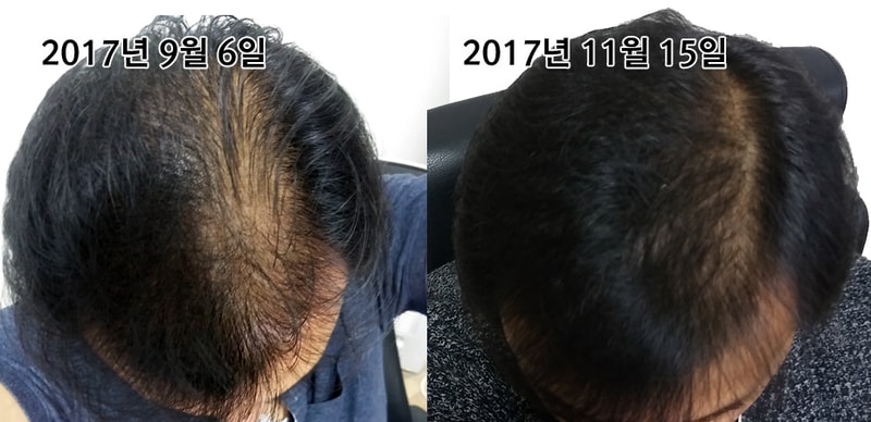 20171115.jpg