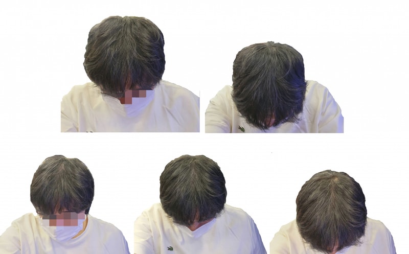앞.jpg