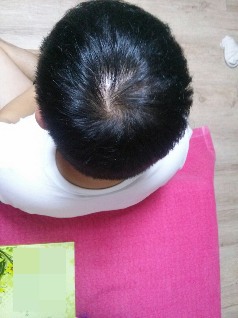 꾸미기_정수리2 20161022.jpg