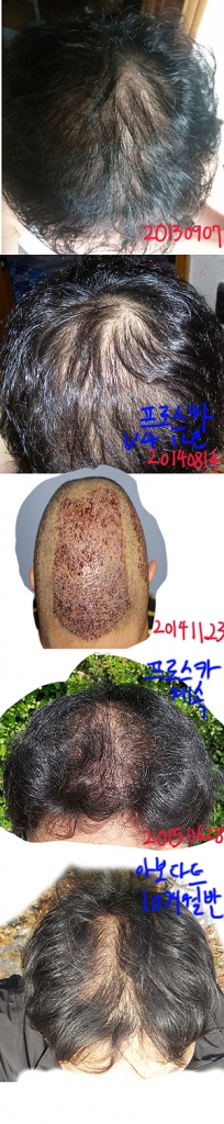 hairless.jpg