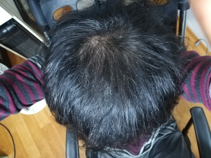 20개월.jpg