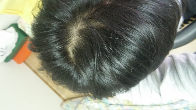 20151210_195918_HDR.jpg
