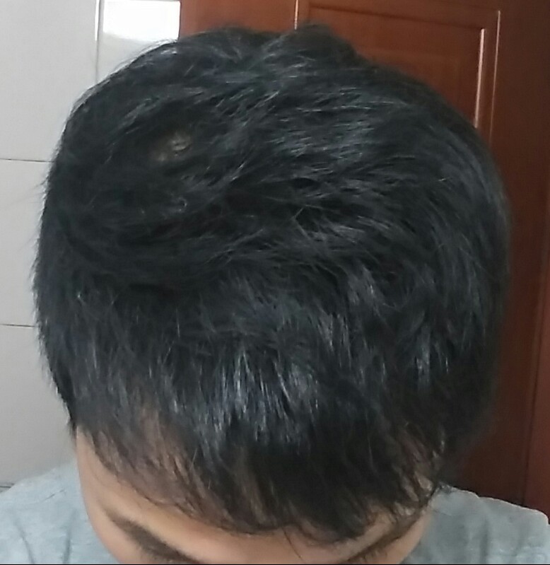 20170124_012200-1.jpg