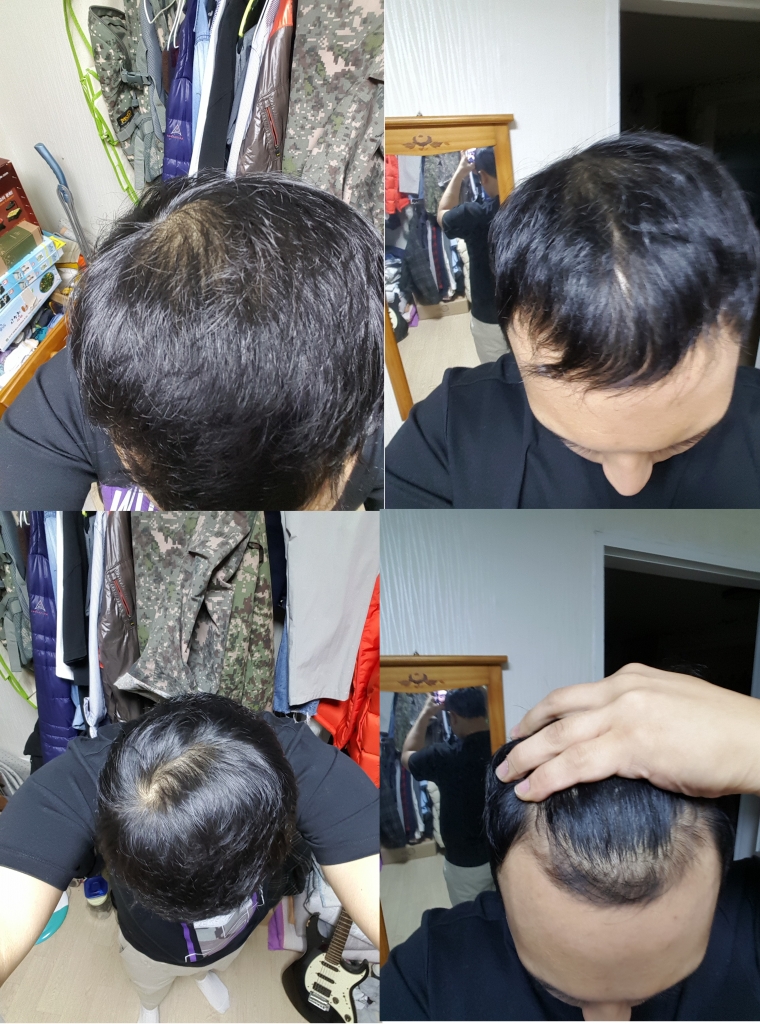 복용전.jpg