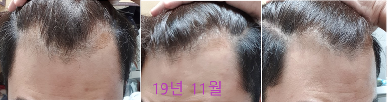 11월 편집본.png