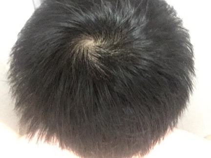 복용후.jpg