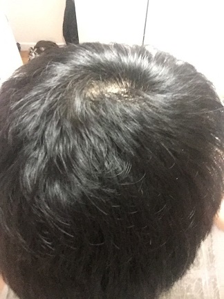 복용후1.jpg