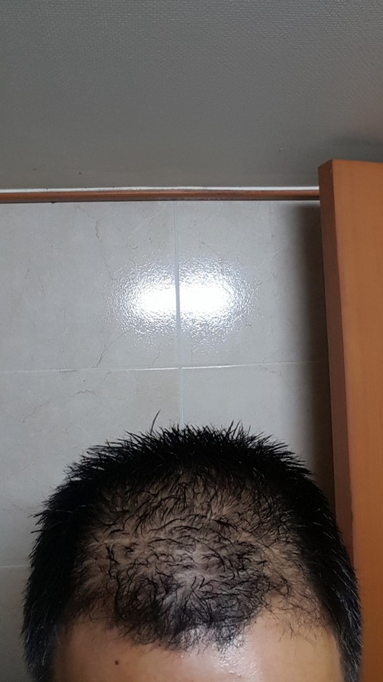복용 전.jpg