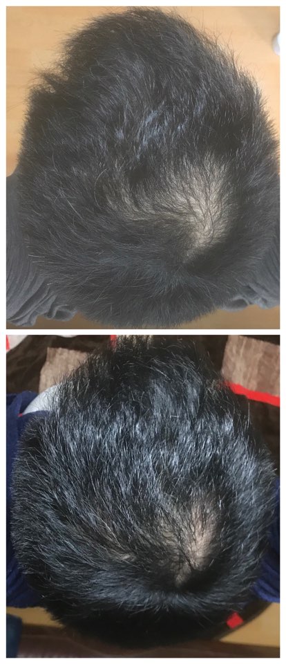 KakaoTalk_20171209_121848825.jpg