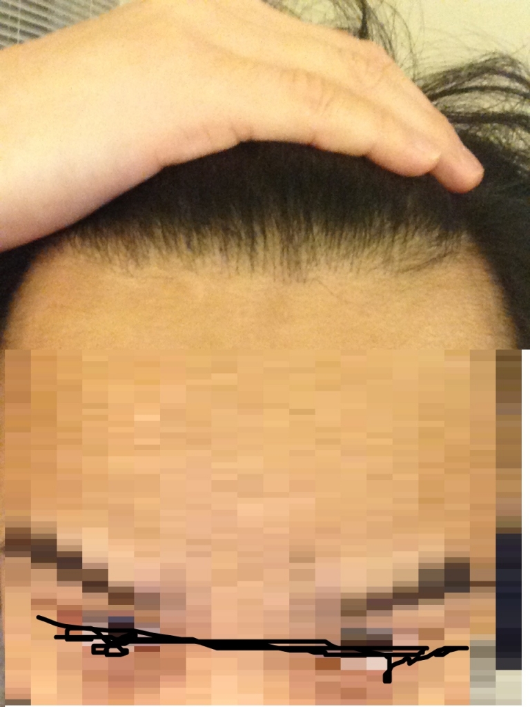 후2.jpg
