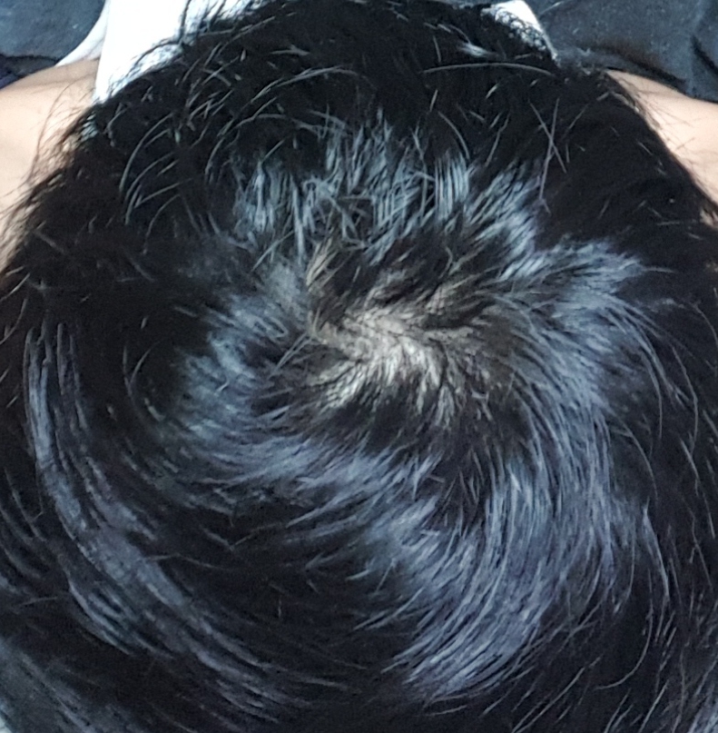 20170501_231057.jpg
