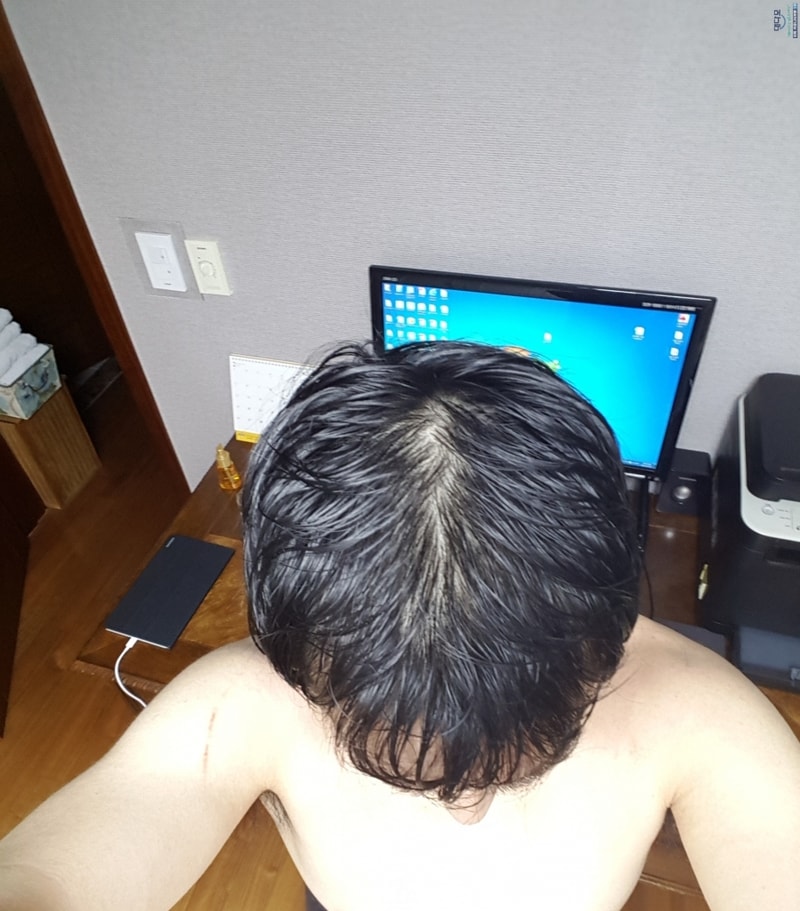 후.jpg