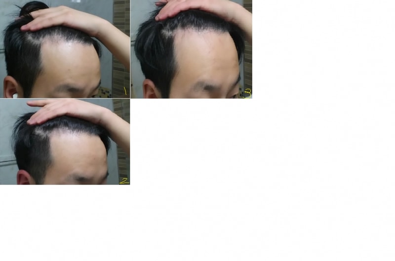 0720일0115일0226일.png