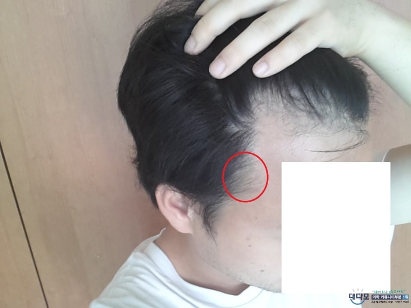 복용전2.jpg