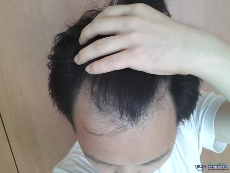 복용전1.jpg