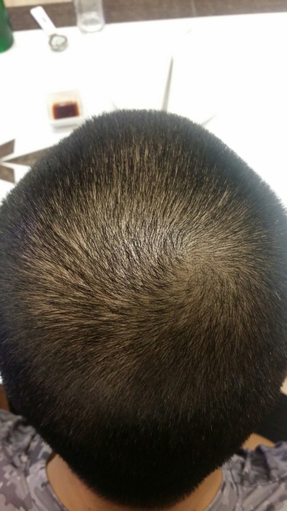 20161023_212235.jpg
