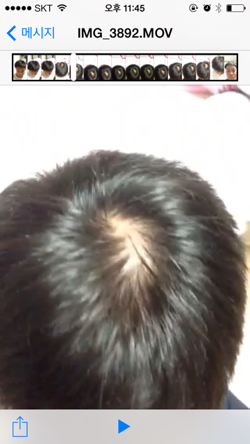 11.png