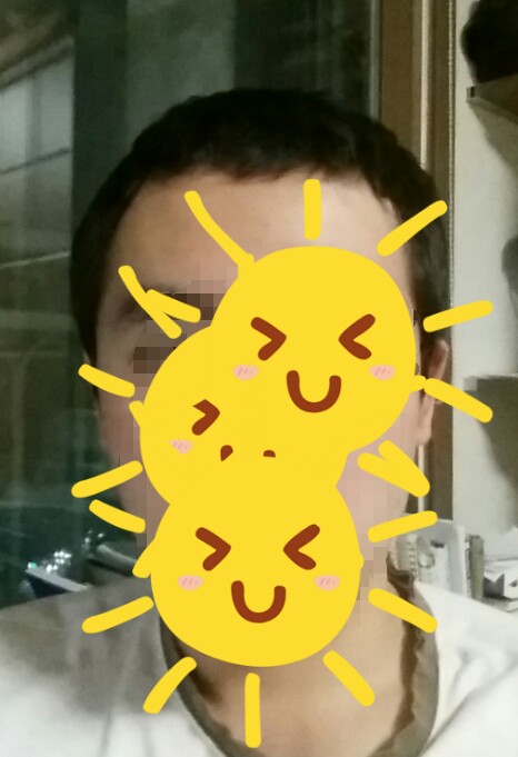 약 복용후.jpg