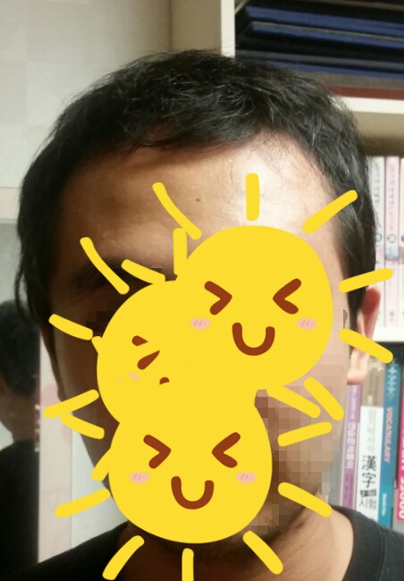 약 복용전.jpg