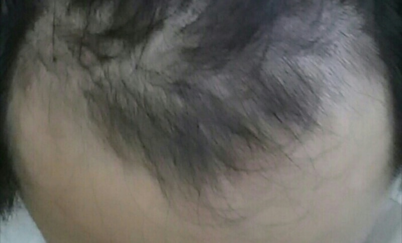 CROP_20170716_205220.JPG