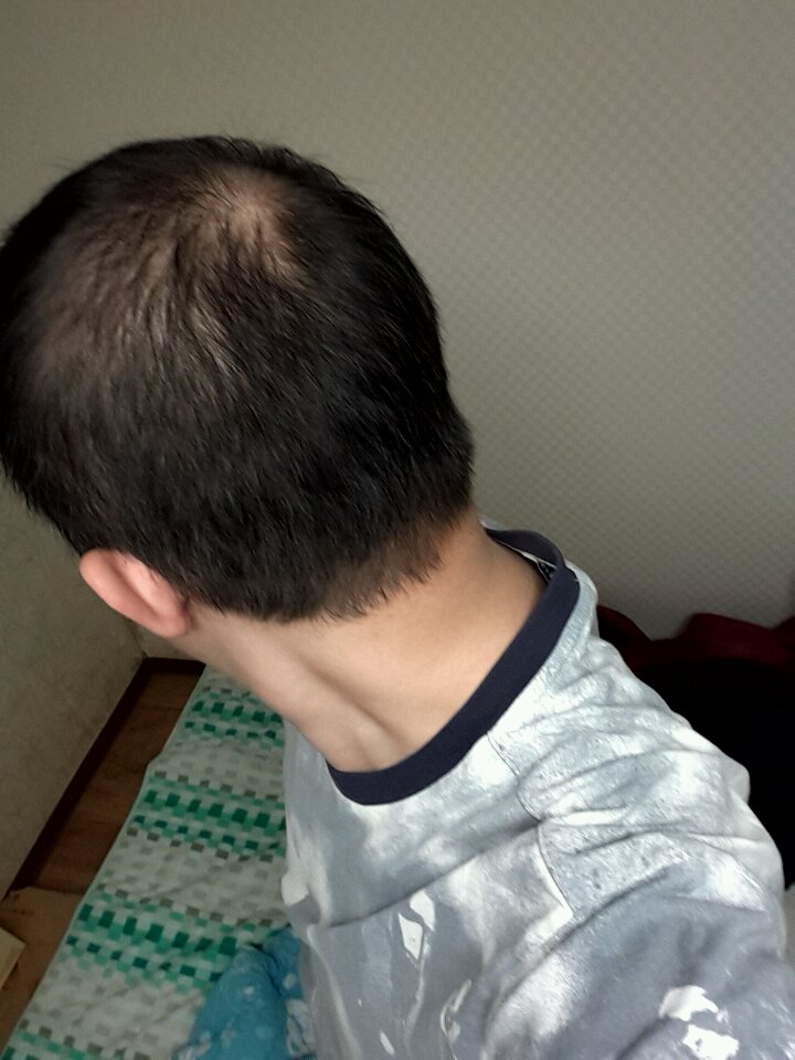 IMG_20141107_014411.jpg