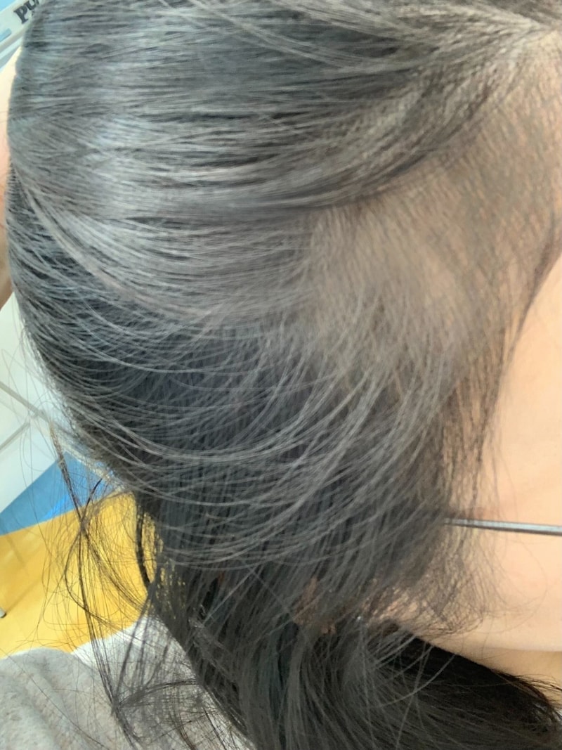 세 달 동안 판토모나 비오틴 먹어봤어요. 달라진거 같나요_ 애프터.jpg