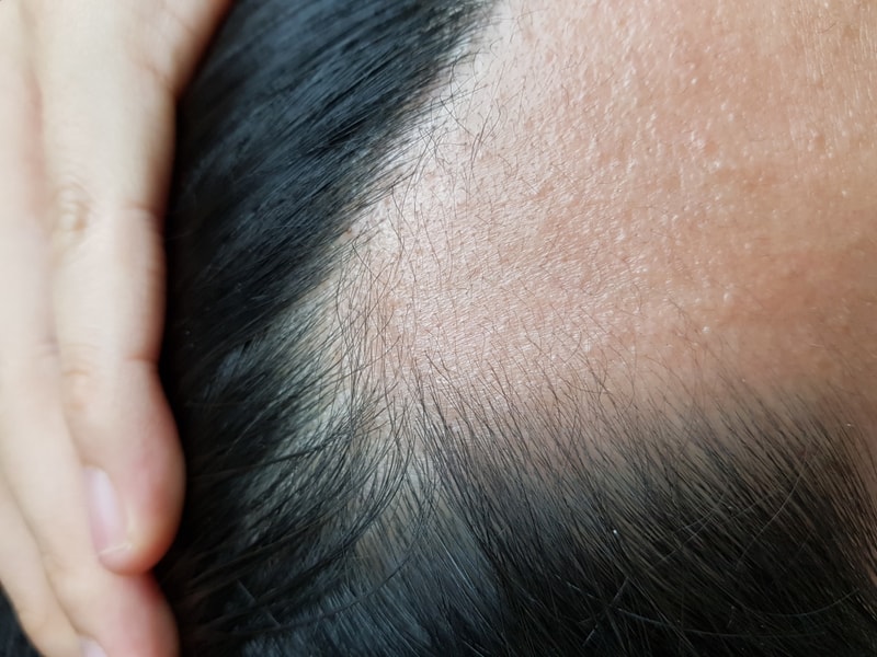KakaoTalk_20180903_231730988.jpg