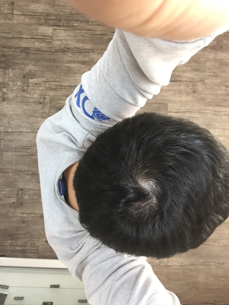 KakaoTalk_20160113_104357908.jpg