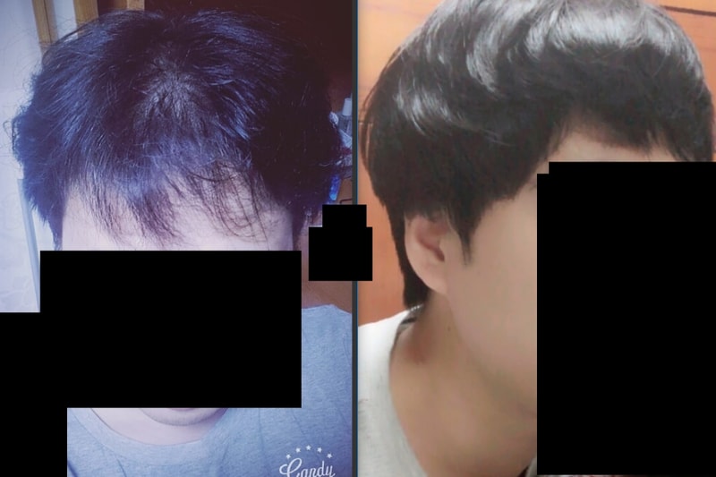 전후사진.PNG