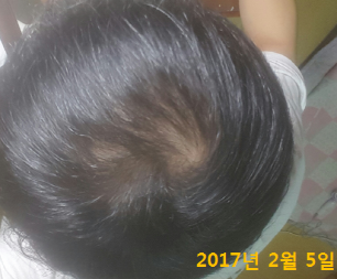 2017년 2월 5일(2).PNG