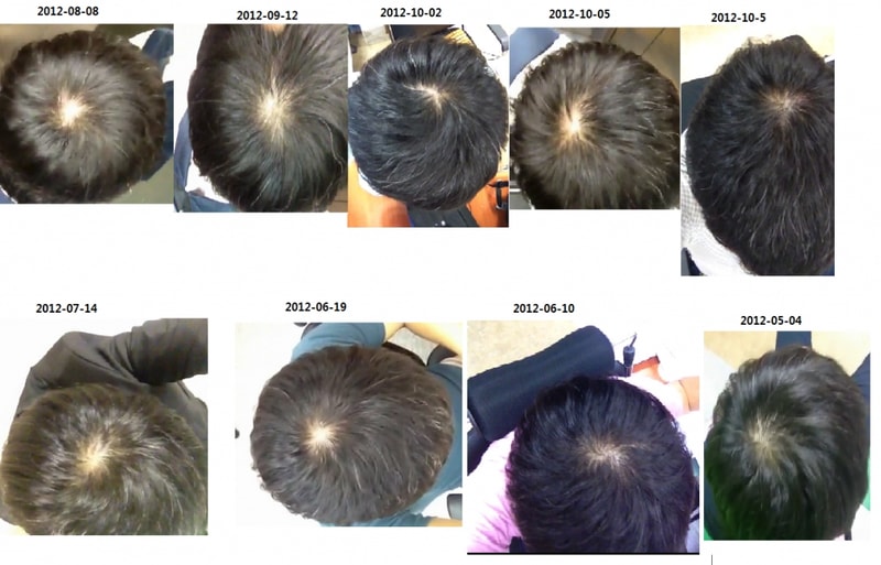 2012-10-5 경과.png
